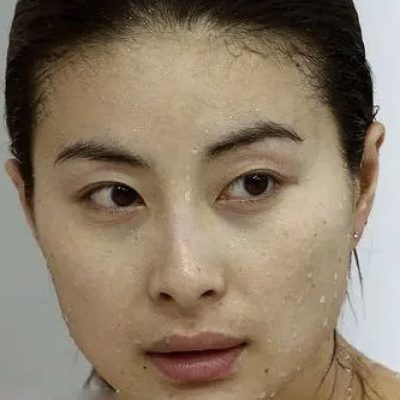 女人有一痣,必嫁豪门 女人凤凰命的痣图片