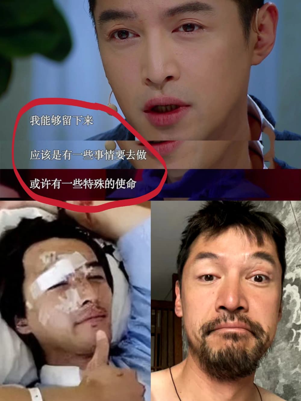 受伤时候的胡歌图片，胡歌伤疤图片_3