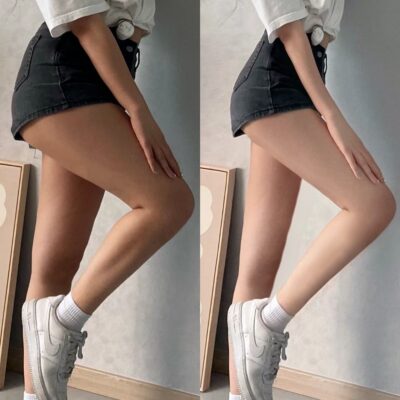 p大腿肌肉的对比图， 高效瘦腿p图