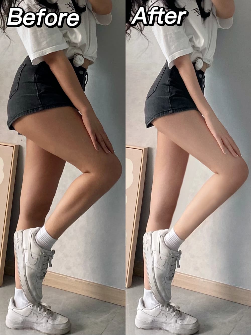 p大腿肌肉的对比图， 高效瘦腿p图_1