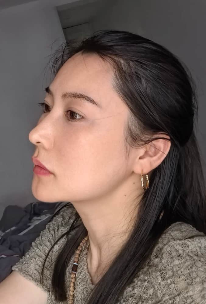 40多岁女人真实皮肤状态图片无美颜无滤镜_3