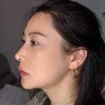40多岁女人真实皮肤状态图片无美颜无滤镜