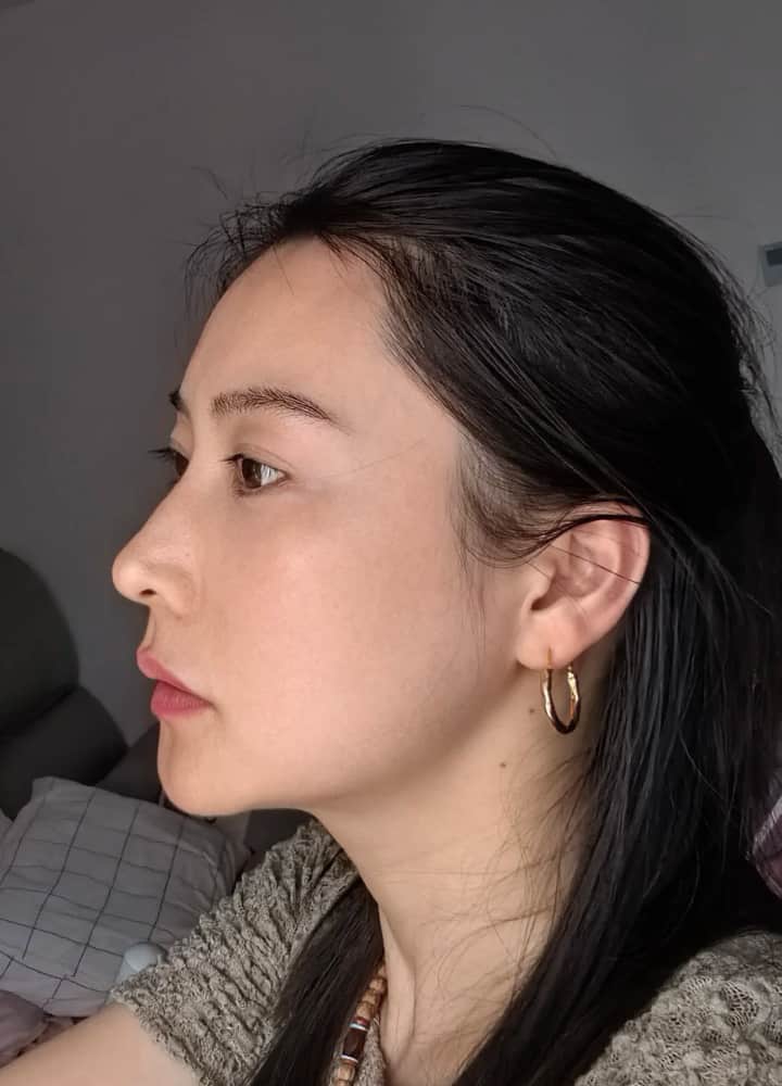 40多岁女人真实皮肤状态图片无美颜无滤镜_4