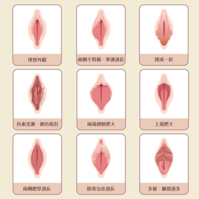 女人荫蒂13-18种类型图片展示全过程