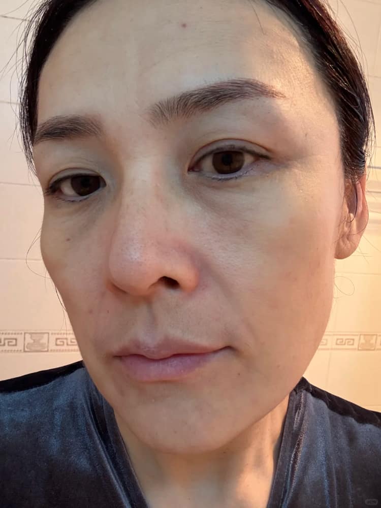 43岁女人真实素颜的皮肤状态图片_2